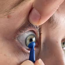 Retrait des lentilles de contact rigides avec une ventouse